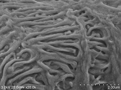 ranal-glomerular-surface-conductive-staining